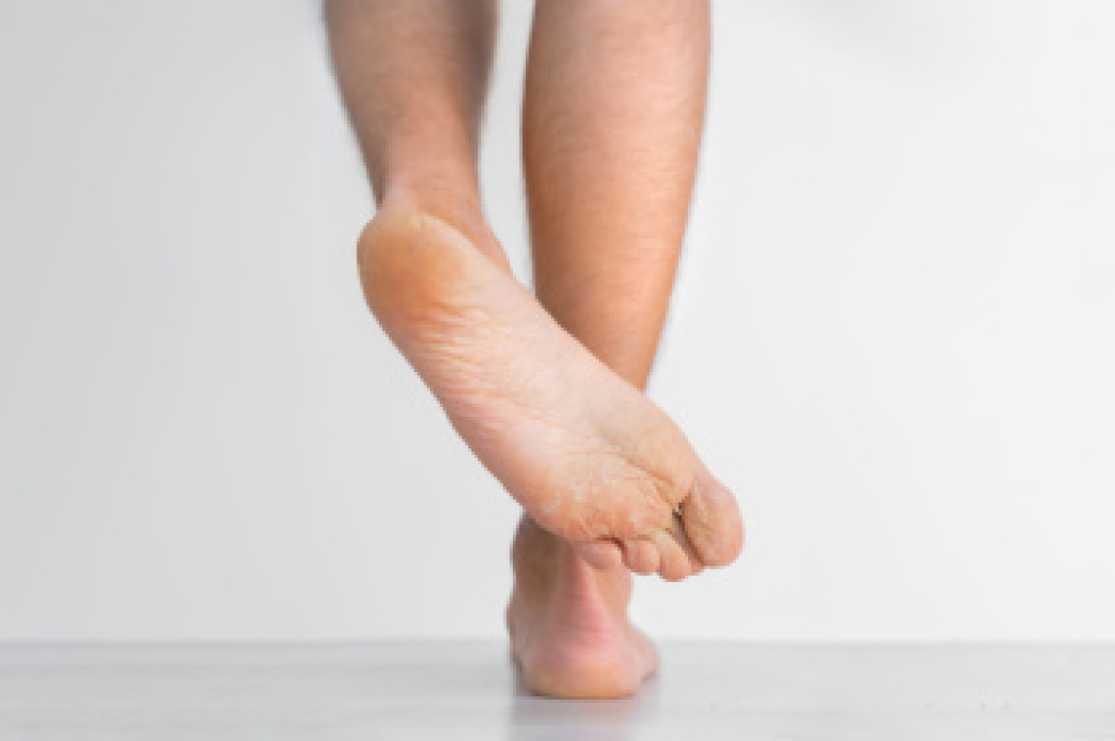 Understanding Athlete’s Foot and When to See a Podiatrist
