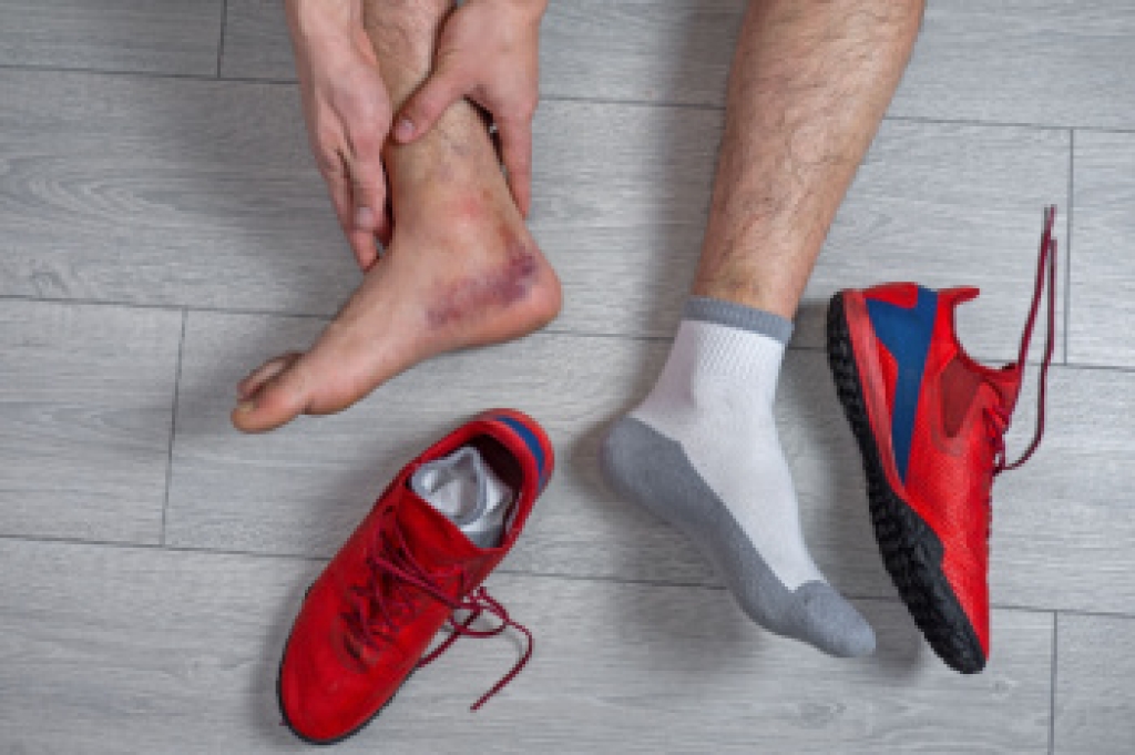 Ankle Sprain Recovery Time and Treatment Options
